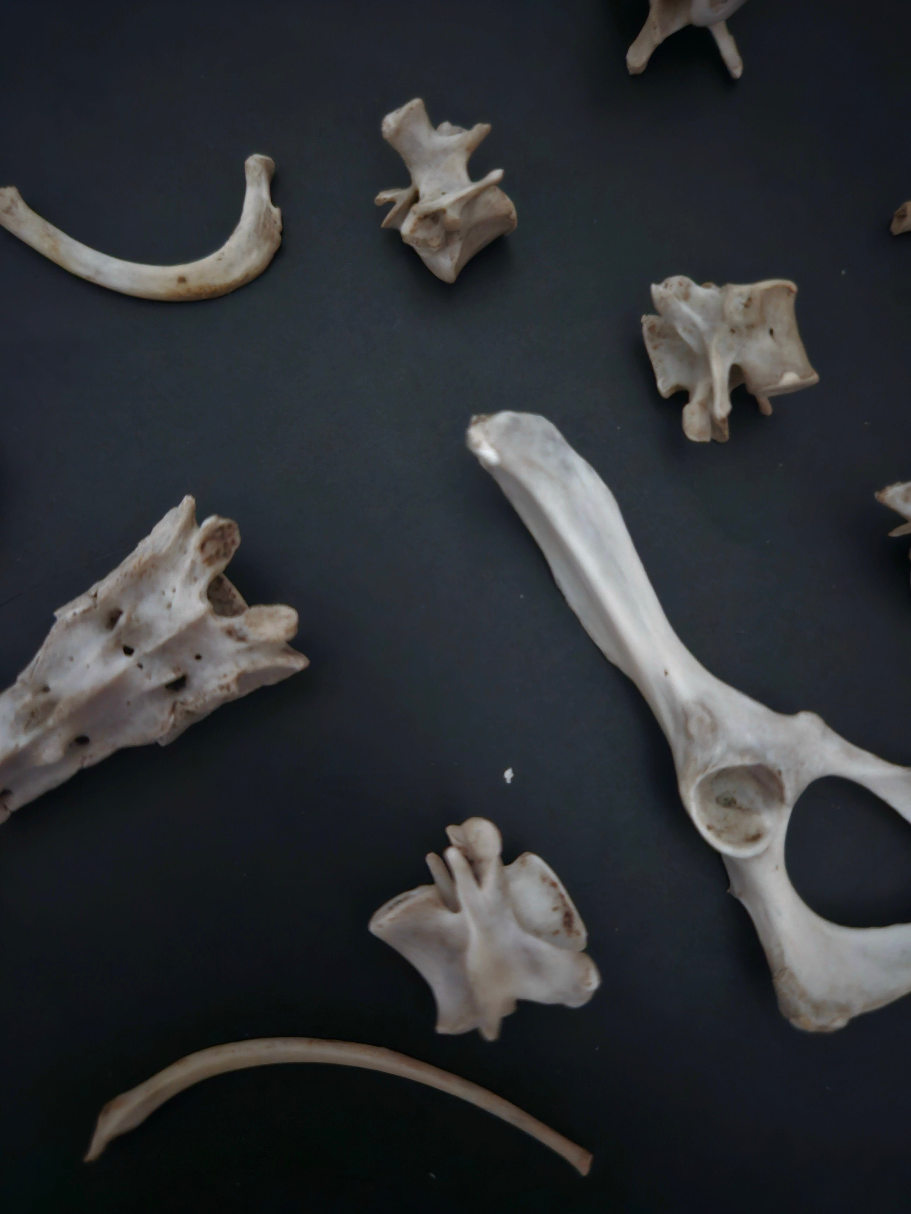 Bones – Links and Bones